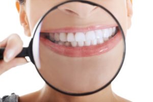 Understanding the Parts of the Teeth