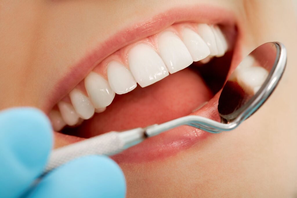 How Often Should I Get Teeth Whitened? 
