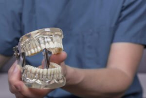 What Are the Different Types of Teeth? 