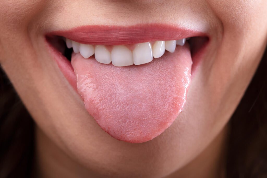 What Does Your Tongue Say About Your Health? 