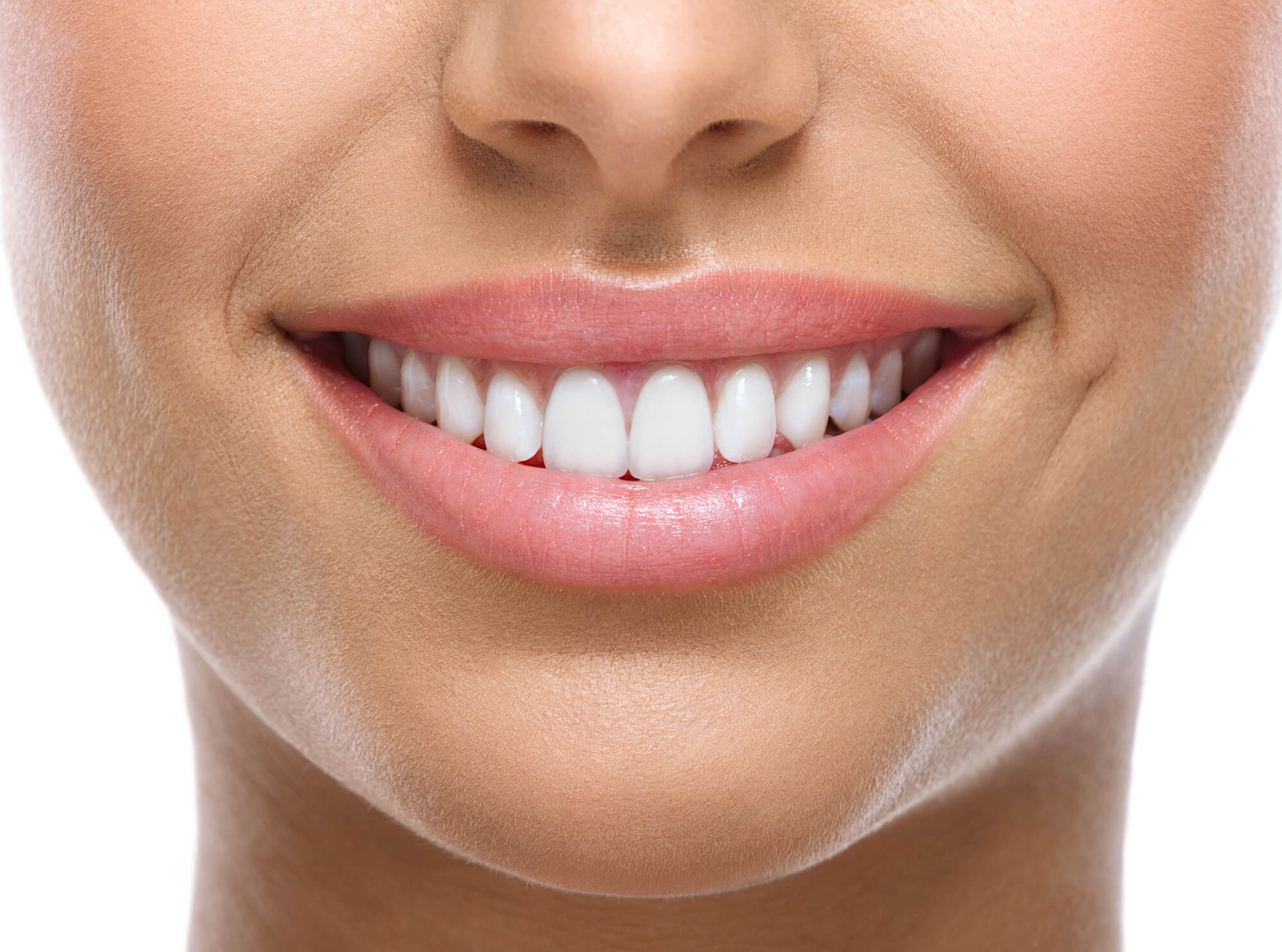 immediate restults of professional Teeth Whitening in Cameron Park