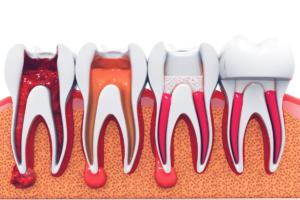a row of teeth with gums